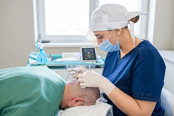 odebírání štěpů před transplantací vlasů